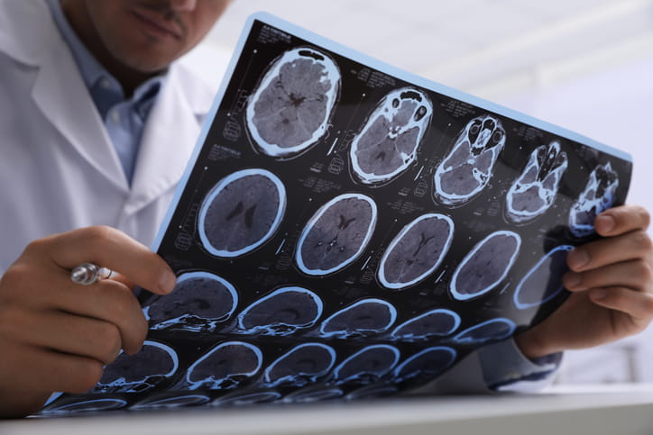 A doctor reviewing brain scans after a patient suffered a brain injury.